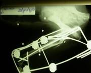 radiografia-180x145